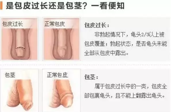 宝鸡宁城县男人皮包过长是怎么样